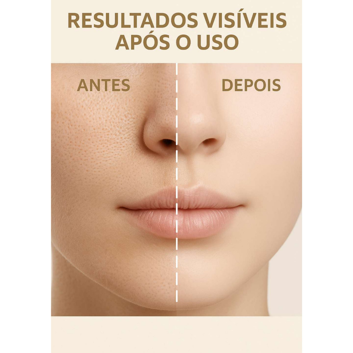 Removedor Elétrico de Cravos e Acne – Aparelho de Sucção a Vácuo para Limpeza Facial e Poros