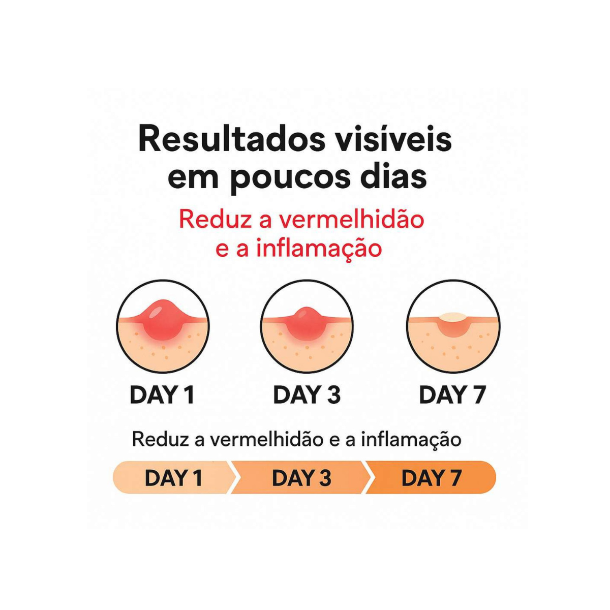 Patches Invisíveis para Acne – Hidrocoloide Cicatrizante e Anti-Espinhas
